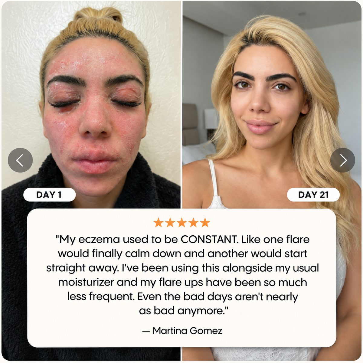 Novera Skin Spray
