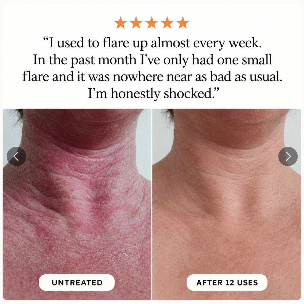 Novera Skin Spray