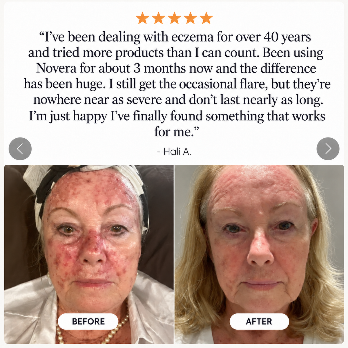 Novera Skin Spray