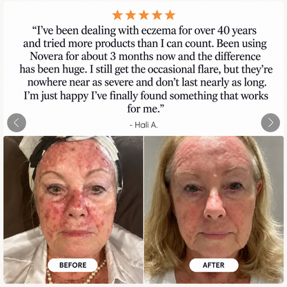 Novera Skin Spray