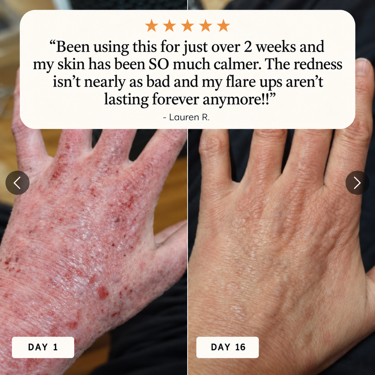 Novera Skin Spray